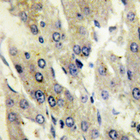  - Anti-Catalase (pY386) Antibody AP59978